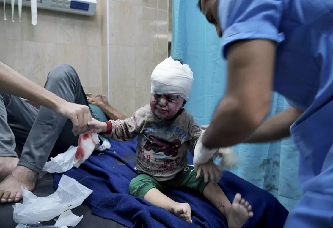غزة... أطفال بلا رؤوس وجراحات من دون تخدير غزة... أطفال بلا رؤوس وجراحات من دون تخدير