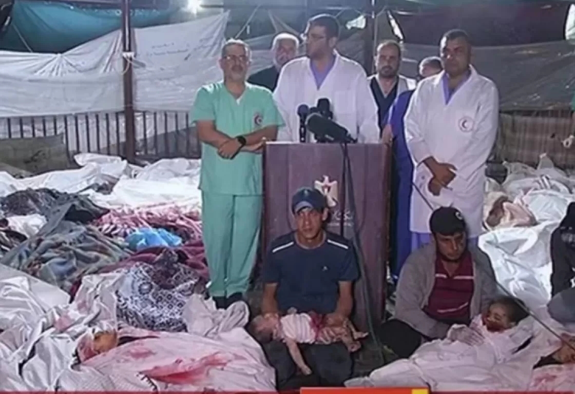لا يحدث إلا في غزة... مؤتمر صحفي وسط جثث الأطفال، وعمليات جراحية دون تخدير لا يحدث إلا في غزة... مؤتمر صحفي وسط جثث الأطفال، وعمليات جراحية دون تخدير