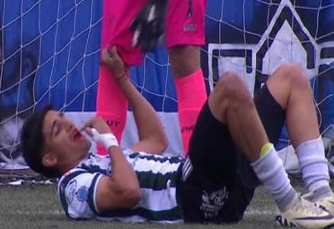 حدث في الدوري الأرجنتيني: الفريق الطبي يبحث عن أسنان لاعب تعرض للكمة حدث في الدوري الأرجنتيني: الفريق الطبي يبحث عن أسنان لاعب تعرض للكمة