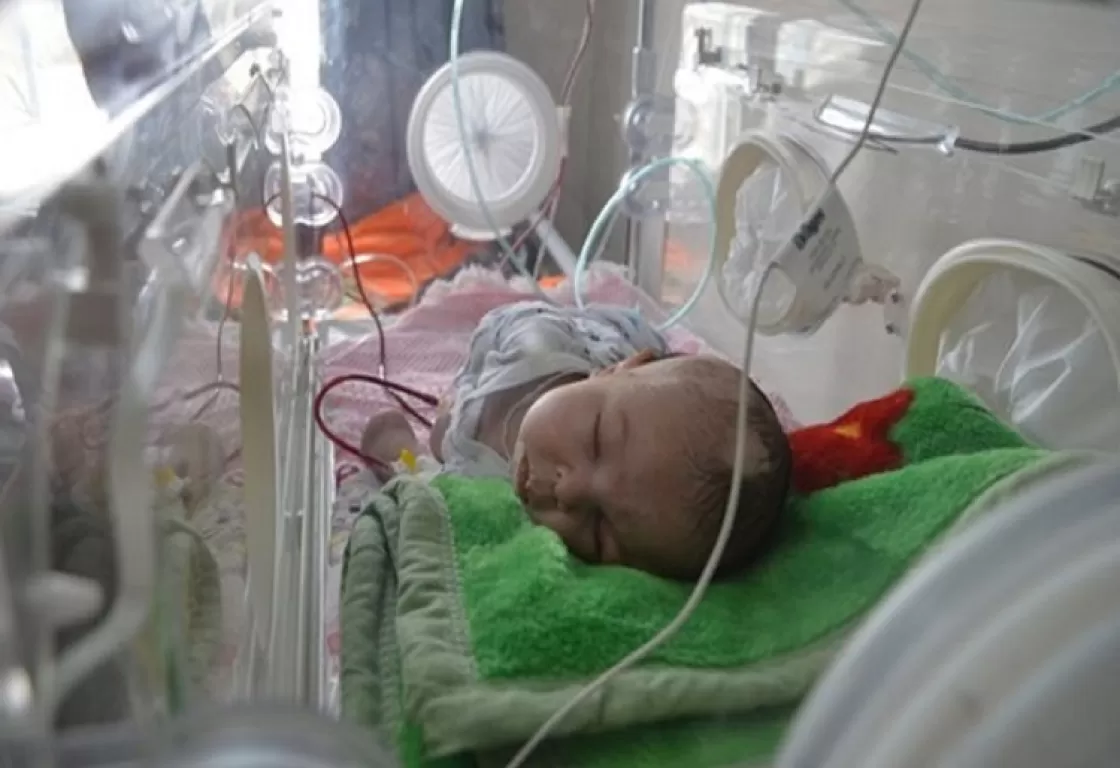 تشوهات خلقية تطال المواليد الجدد في غزة جراء مخلفات القصف الإسرائيلي تشوهات خلقية تطال المواليد الجدد في غزة جراء مخلفات القصف الإسرائيلي
