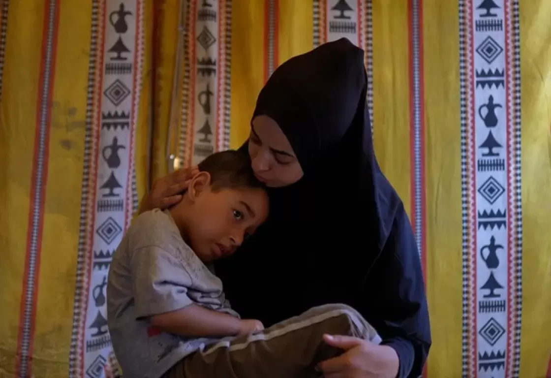 الهجمات الإسرائيلية تؤدي إلى زيادة حالات التشوهات الخَلقية للأطفال بغزة الهجمات الإسرائيلية تؤدي إلى زيادة حالات التشوهات الخَلقية للأطفال بغزة