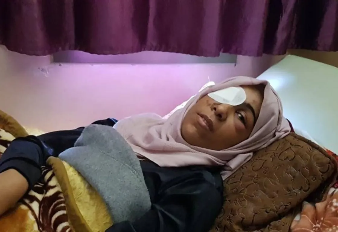 "بين الفقد والأمل"... عيون اصطناعية تعيد التوازن لوجوه جرحى غزة