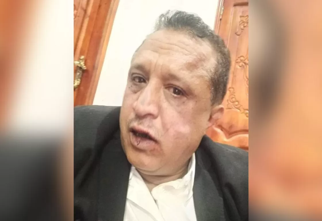 هرب من قمع الإخوان في صنعاء.. سلطات الإخوان بتعز تعتقل الصحفي مجلي الصمدي هرب من قمع الإخوان في صنعاء.. سلطات الإخوان بتعز تعتقل الصحفي مجلي الصمدي