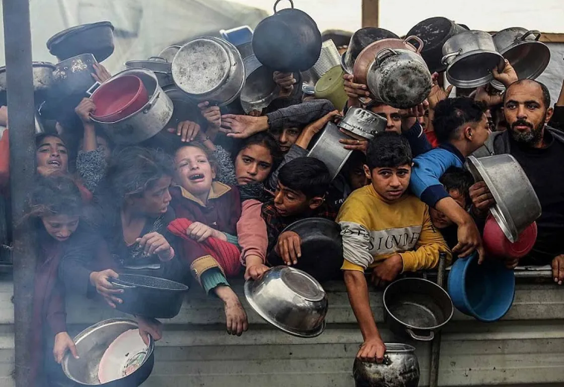الأطفال المصابون بسوء التغذية في غزة: وجوه صغيرة تحكي قصة الجوع 